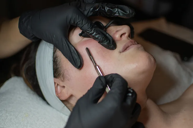 Dermaplane treatment removing dead skin with a sterile blade
