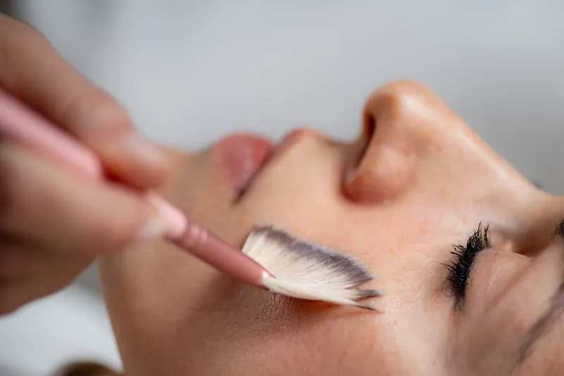 PCA certified esthetician applying a professional chemical peel